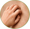 Khujli - itching
